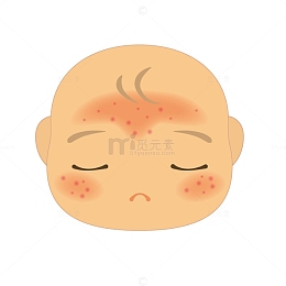 卡通婴儿湿疹