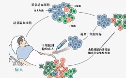 干细胞移植技术