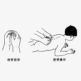 小儿推拿捏脊