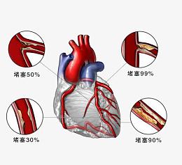 心脏疾病