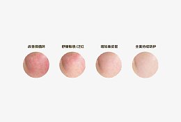 皮肤过敏痊愈过程图