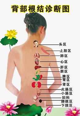 背部根结诊断图