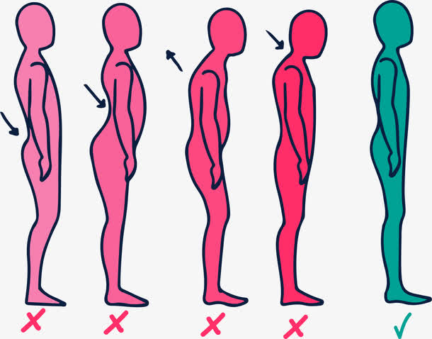 脊柱骨骼弯曲