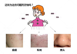 别挤痘痘