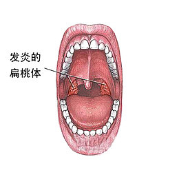 癌症的病变