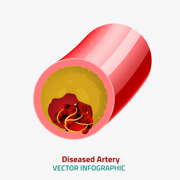 卡通血管里的红细胞