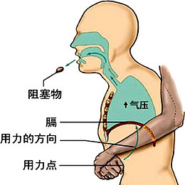 嗓子被卡急救方法