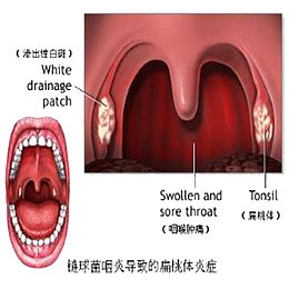 手绘喉咙细节图