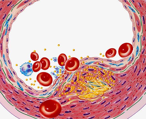 血脂细胞插图
