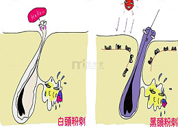 毛孔粗大