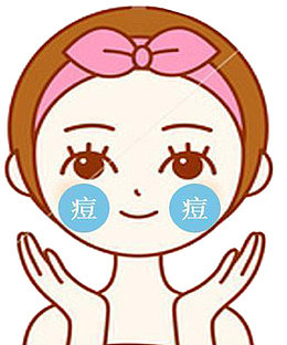 微笑女孩心态好面对痘痘