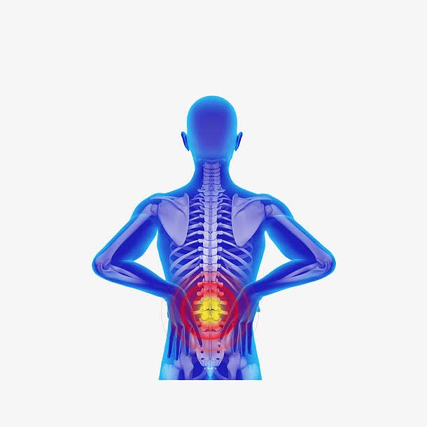 手绘腰椎疼痛X光人体图素材