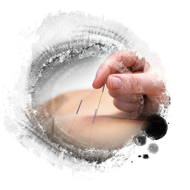 墨迹蒙版针灸海报