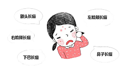额头长痘悲伤女孩