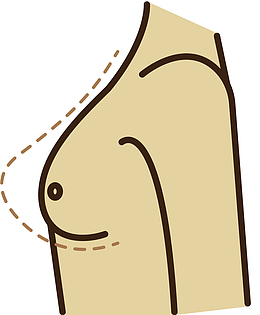 乳房隆胸矢量卡通整形