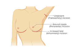 卡通人物裸体的女性乳房元素