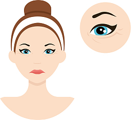 眼角皱纹卡通女孩