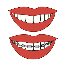 卡通矫正牙齿前后对比图示插画免
