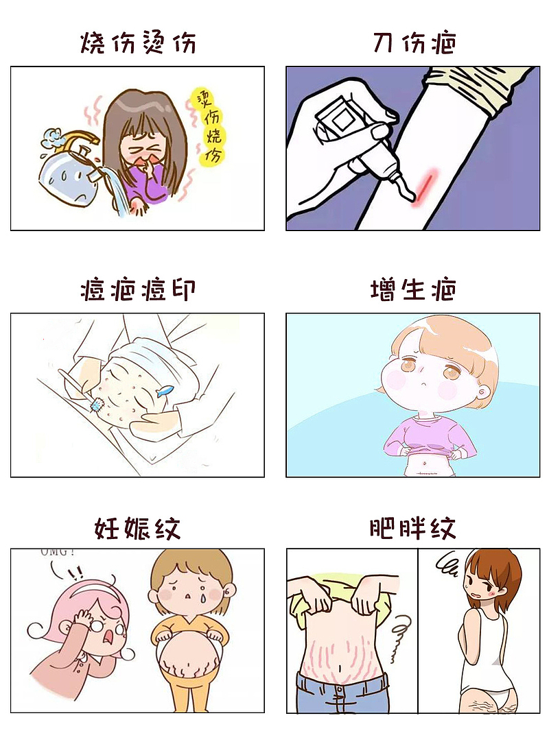 烧伤烫伤疤痕、祛疤