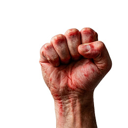 血迹斑斑紧握的拳头图片